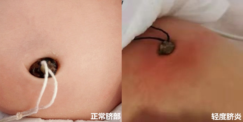 NeoImage_副本.jpg